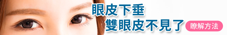 眼皮下垂 雙眼皮不見了