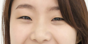 單眼皮 單眼皮