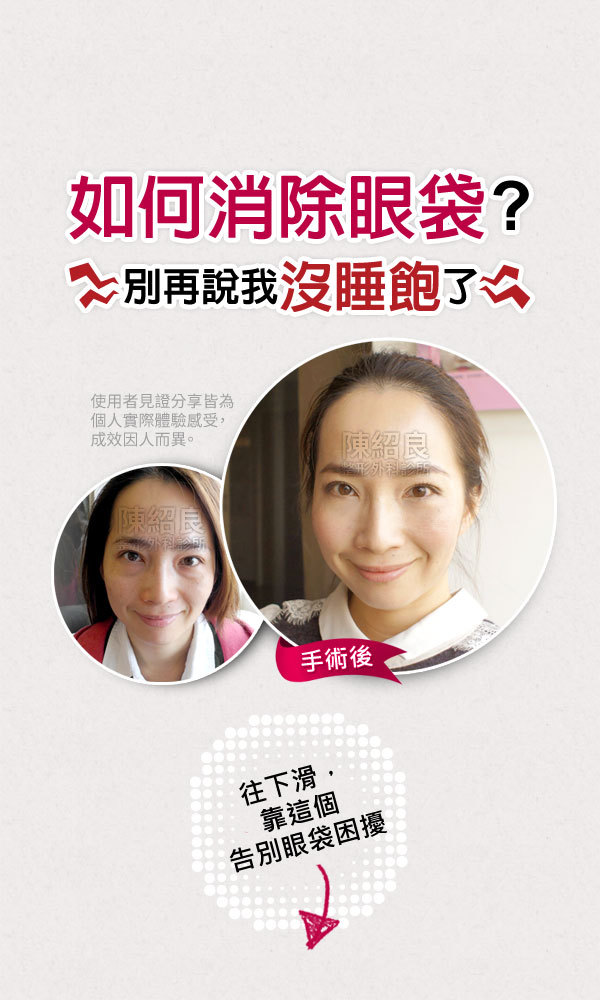 如何消除眼袋 如何消除眼袋