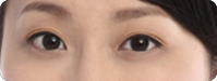 大小眼 大小眼